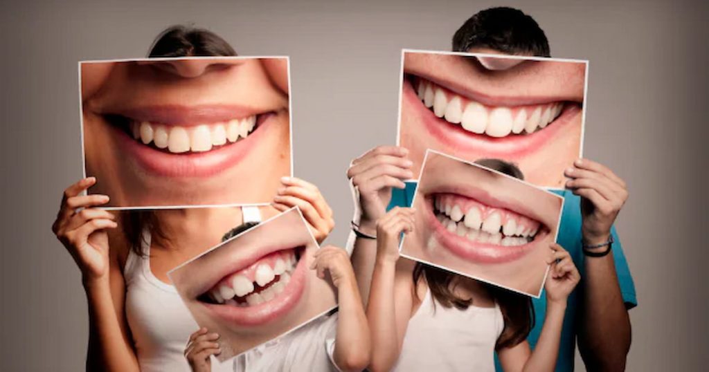 Cosmetic Dentistry Benefits