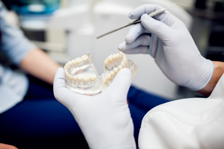 Different types of dental implants