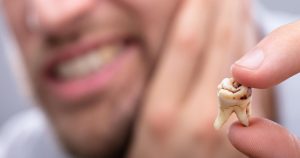 Preventing Tooth Decay