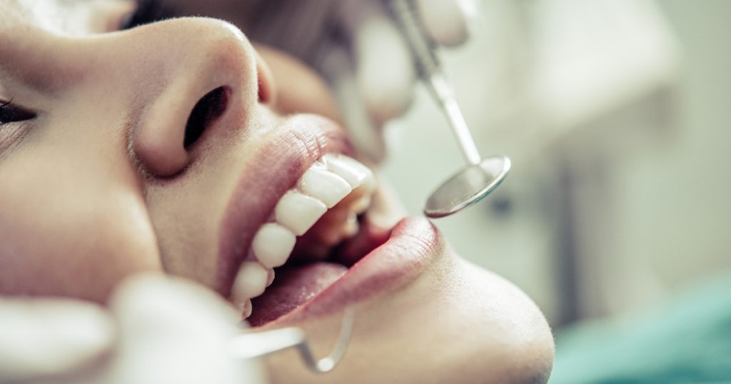 Dental Restoration
