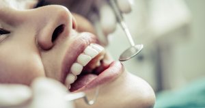 Dental Restoration