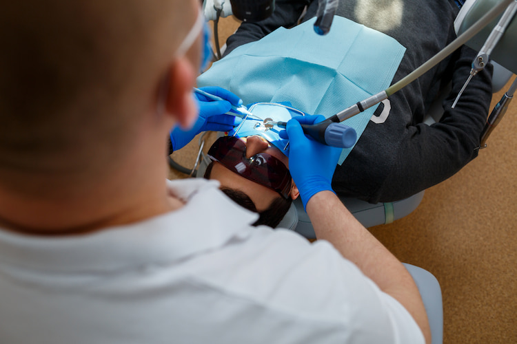 Myths About Root Canals