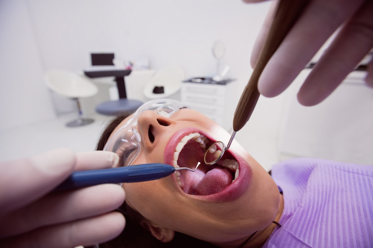 Dental Filling Can Improve Your Oral Health