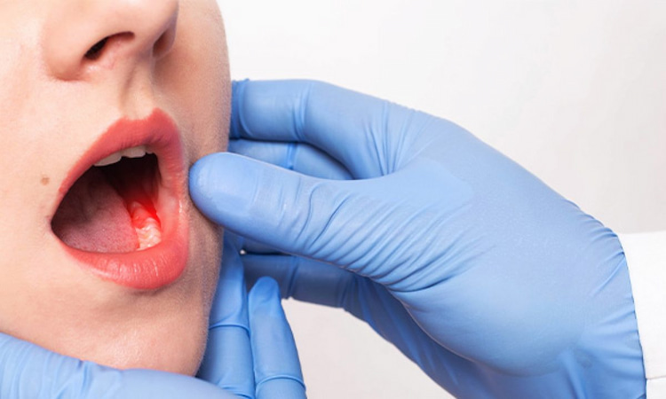 My Toothache Needs Emergency Dental Care