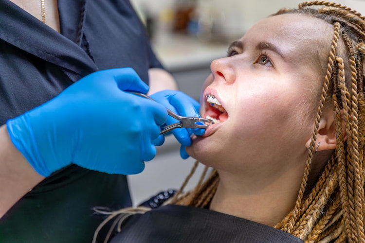 A woman is getting her wisdom teeth out, showing the Importance of removing wisdom teeth