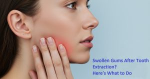 How to Handle Swollen Gums After a Tooth Extraction