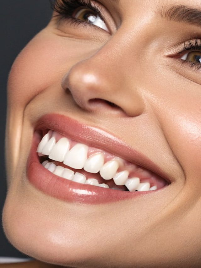 an image of dental veneers looking great embracing a perfect smile