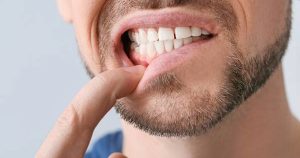 a photo showing a man pointing to gum recession