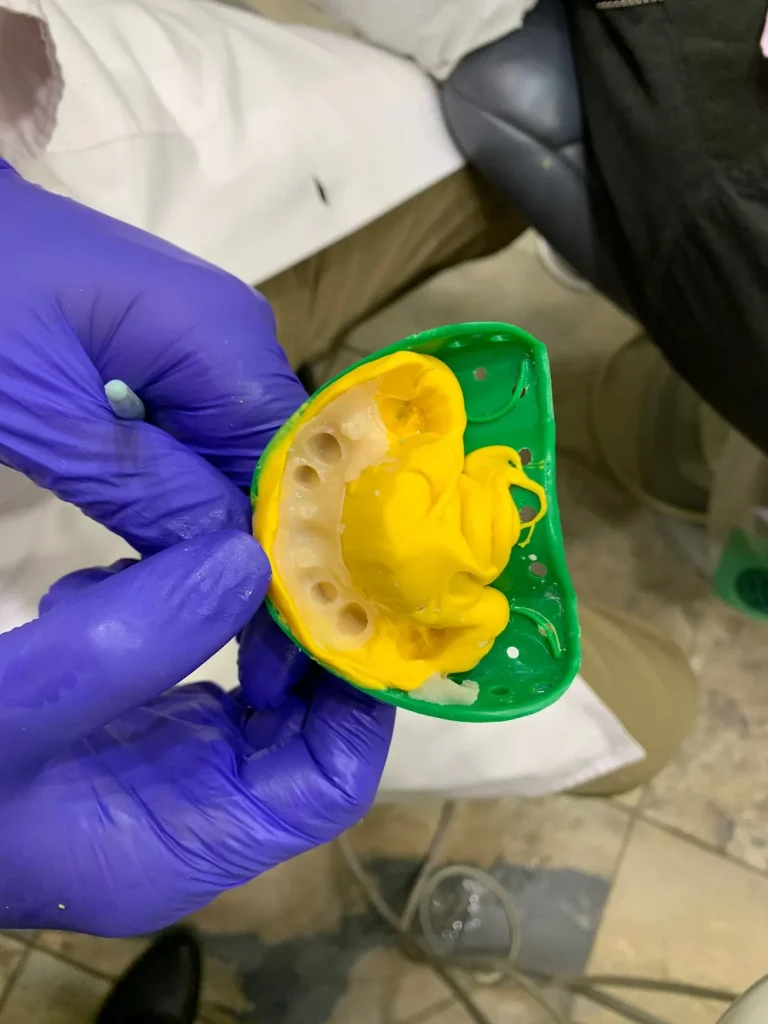 What to expect from consultation to final tooth