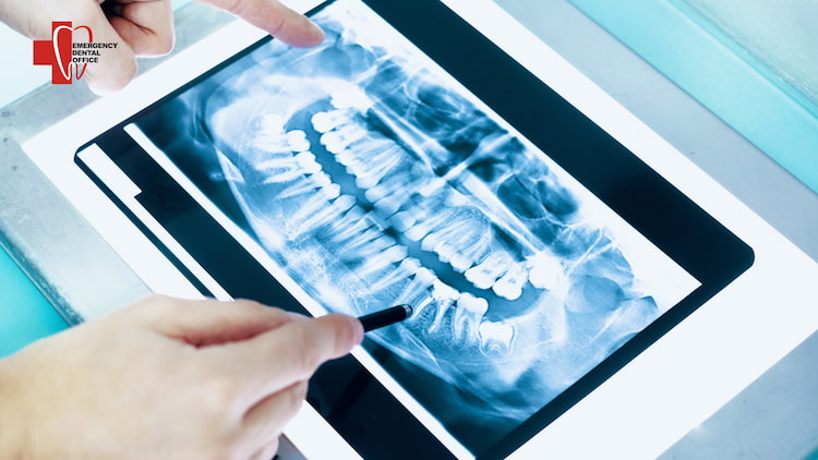 a photo of dental examination for tooth infection 