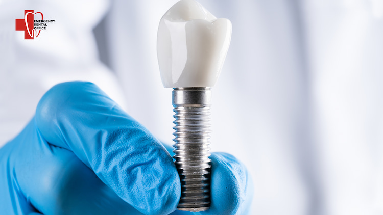 a photo of the dental implant and common complication after dental implant surgery