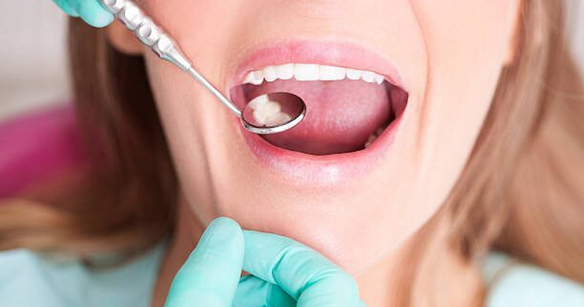 a photo of an exposed tooth root as a dental emergency