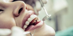 Dental Restoration
