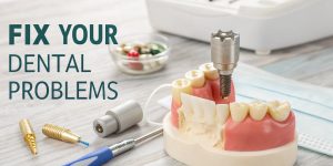 How Can Dental Crowns Fix Your Dental Problems?